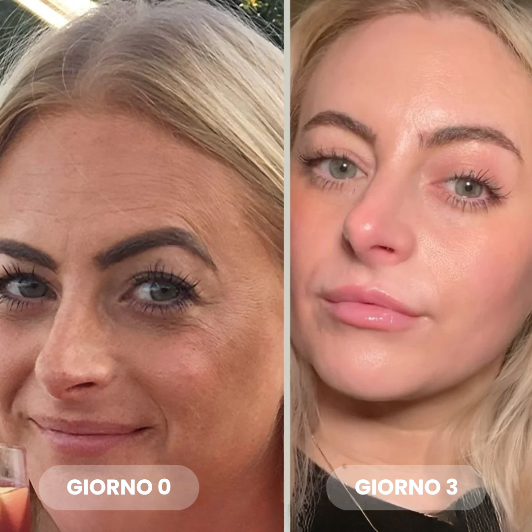 Maschera Bio-Collagene Riduci Rughe del 75% dopo 1 sola applicazione