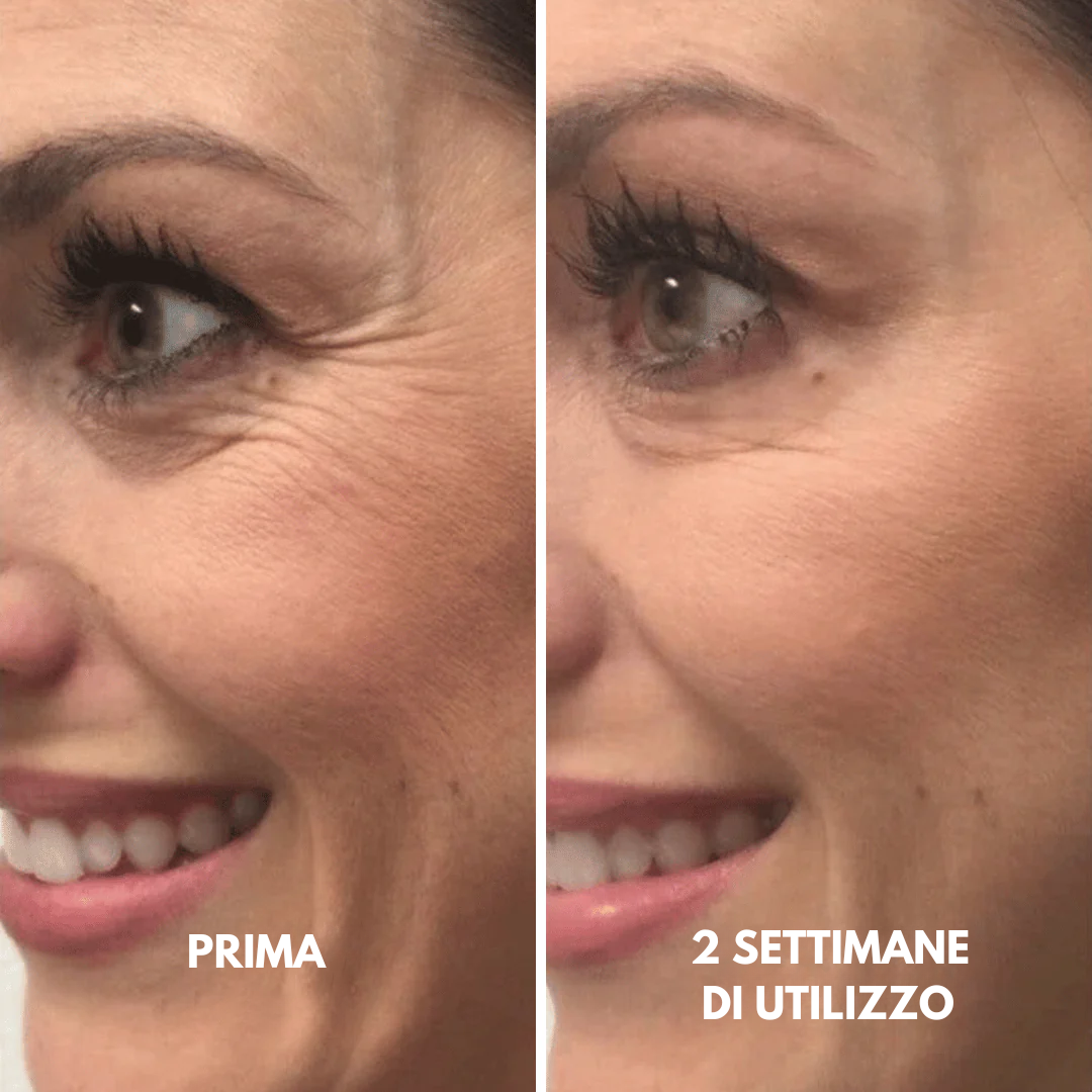 Lushia™ L’alternativa di nuova generazione al retinolo