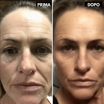 Lushia™ L’alternativa di nuova generazione al retinolo