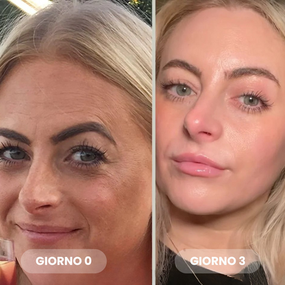 Maschera Bio-Collagene Riduci Rughe del 75% dopo 1 sola applicazione