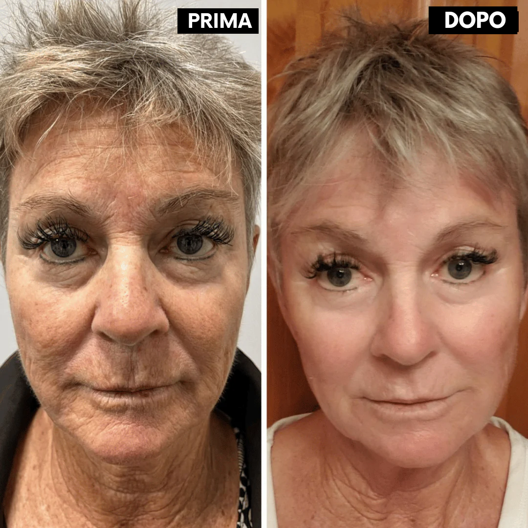 Lushia™ L’alternativa di nuova generazione al retinolo