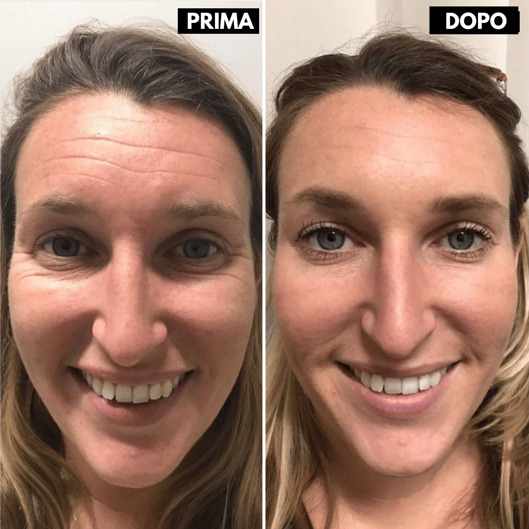 Lushia™ L’alternativa di nuova generazione al retinolo