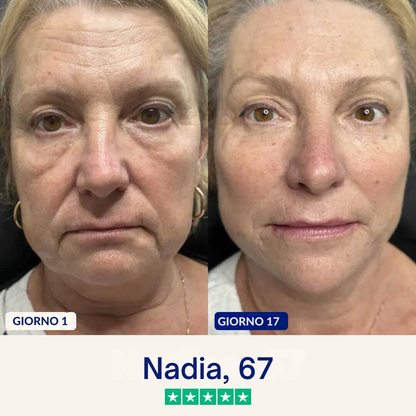 Maschera anti-doppio mento Lushia (V2)