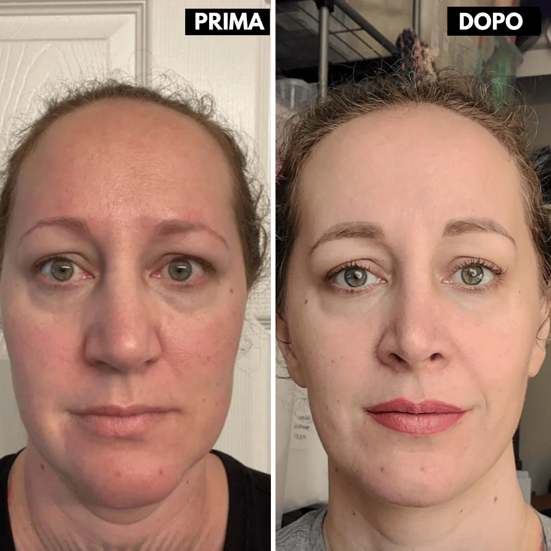 Lushia™ L’alternativa di nuova generazione al retinolo