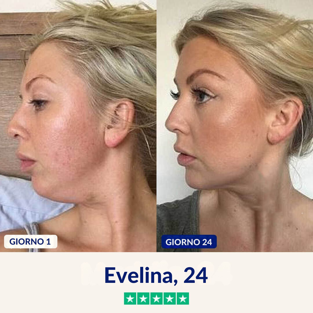 Maschera anti-doppio mento Lushia (V2)