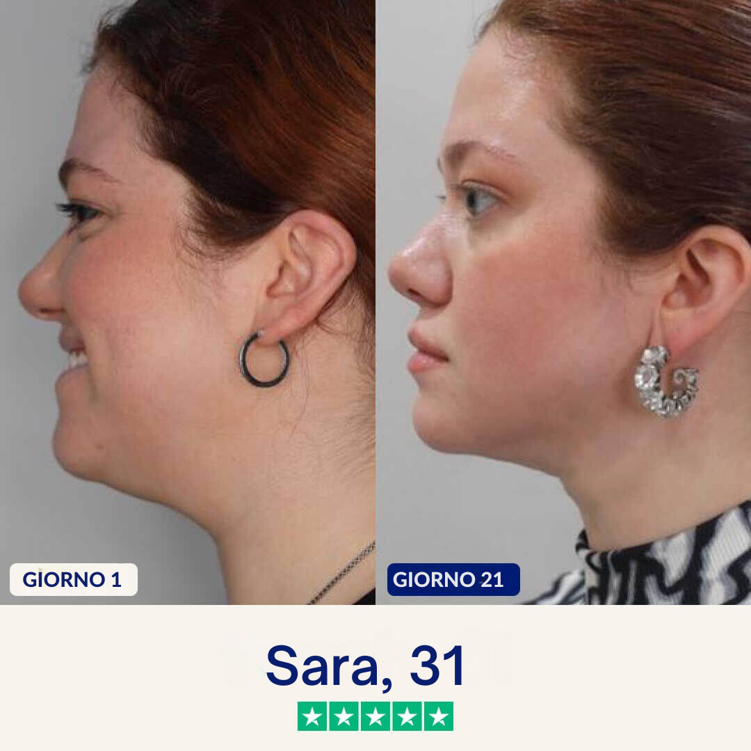 Maschera anti-doppio mento Lushia (V2)