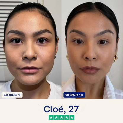 Maschera anti-doppio mento Lushia (V2)