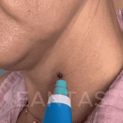 Lushia™ – Pelle liscia in soli 4 giorni