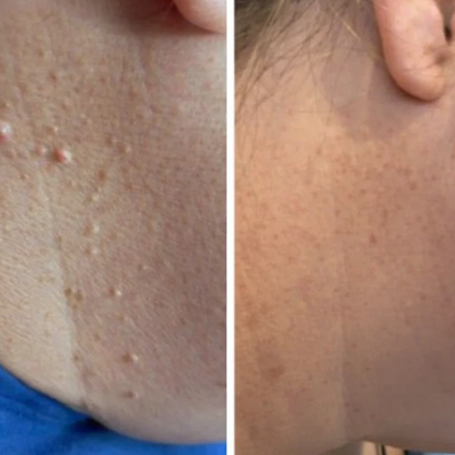 Lushia™ – Pelle liscia in soli 4 giorni