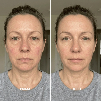 Lushia™ – Spazzola per drenaggio linfatico viso